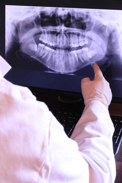 Best Emergency Dentist for Knocked-Out Tooth in Willowbrook, CA